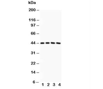 Western blot testing of SIRT3 antibody and Lane 1: rat spleen; 2: human placenta; 3: HeLa; 4: COLO320~