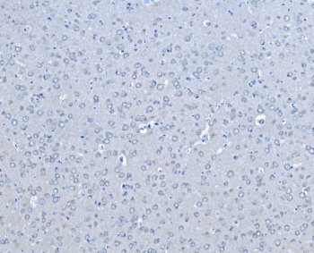 IHC staining of FFPE rat brain tissue with BRAF antibody. HIER: boil tissue sections in pH8 EDTA for 20 min and allow to cool before testing.