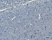 IHC staining of FFPE mouse brain tissue with BRAF antibody. HIER: boil tissue sections in pH8 EDTA for 20 min and allow to cool before testing.