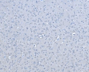 IHC staining of FFPE rat brain tissue with BRAF antibody. HIER: boil tissue sections in pH8 EDTA for 20 min and allow to cool before testing.