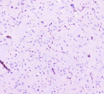 IHC staining of FFPE mouse brain tissue with Caveolin-1 antibody. HIER: boil tissue sections in pH8 EDTA for 20 min and allow to cool before testing.