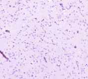 IHC staining of FFPE mouse brain tissue with Caveolin-1 antibody. HIER: boil tissue sections in pH8 EDTA for 20 min and allow to cool before testing.