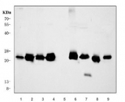Western blot testing of 1) human HeLa, 2) human A549, 3) human placenta, 4) human A431, 5) human HL60, 6) rat ovary, 7) rat heart, 8) mouse ovary and 9) mouse heart tissue lysate with Caveolin-1 antibody. Predicted molecular weight ~21 kDa.