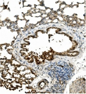 IHC staining of FFPE rat lung with Caveolin-2 antibody. HIER: boil tissue sections in pH8 EDTA for 20 min and allow to cool before testing.