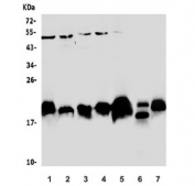 Western blot testing testing of human 1) HT1080, 2) U-2 OS, 3) Caco-2, 4) HeLa, 5) A549, 6) rat lung and 7) mouse lung lysate with Caveolin-2 antibody. Predicted molecular weight ~18 kDa.