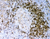IHC staining of FFPE human tonsil tissue with CD79a antibody. HIER: boil tissue sections in pH8 EDTA for 20 min and allow to cool before testing.