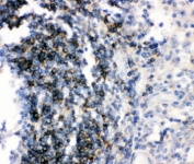 IHC staining of FFPE human tonsil tissue with CD79b antibody, HRP-secondary and DAB substrate. HIER: boil tissue sections in pH6 citrate buffer for 20 min and allow to cool before testing.