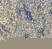 IHC staining of FFPE human spleen tissue with CD79b antibody, HRP-secondary and DAB substrate. HIER: boil tissue sections in pH8 EDTA for 20 min and allow to cool before testing.