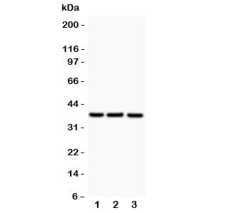 Western blot testing of CD79b antibody and Lane 1: Raji; 2: HL-60; 3: HUT; Predicted/Observed size: 26~39KD