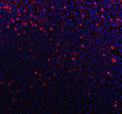 Western blot testing of CD79b antibody and human cell lysate 1:  Raji;  2: HL-60;  3: HUT;  Predicted molecular weight: 26~39 kDa.