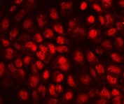 Immunofluorescent staining of FFPE human A431 cells with CD79b antibody. HIER: boil tissue sections in pH6, 10mM citrate buffer, for 20 min and allow to cool before testing.