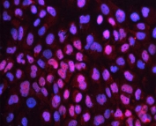 Immunofluorescent staining of FFPE human A431 cells with CD79b antibody (red) and DAPI nuclear stain (blue). HIER: boil tissue sections in pH6, 10mM citrate buffer, for 20 min and allow to cool before testing.