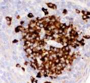 IHC staining of FFPE human tonsil tissue with CD82 antibody. HIER: boil tissue sections in pH8 EDTA for 20 min and allow to cool before testing.