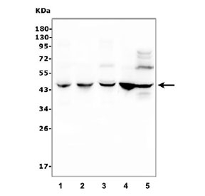 Western blot testing of 1) rat liver, 2) rat kidney, 3) mouse liver, 4) mouse kidney and 5) human HeLa cell lysate with C/EBP beta antibody. Expected molecular weight: 36-41 kDa.