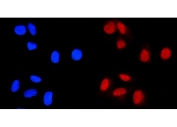 Immunofluorescent staining of FFPE human U-2 OS cells with C/EBP beta antibody (red) and DAPI nuclear stain (blue). HIER: steam section in pH6 citrate buffer for 20 min.