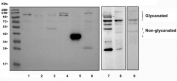 Western blot testing testing of human 1) MCF-7, 2) HeLa, 3) HepG2, 4) SW620, 5) rat liver, 6) rat RH35, 7) rat PC-12, 8) rat C6 and 9) mouse thymus lysate with Decorin antibody. Predicted molecular weight ~40 kDa (non-glycanated), 90-140 kDa (glycanated).