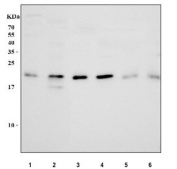 Western blot testing of DHFR antibody and recombinant human protein (0.5ng)