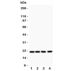 Western blot testing of DHFR antibody and Lane 1: rat liver; 2: mouse liver; 3: human HepG2; 4: (h) Jurkat. Predicted/observed size 21~24KD