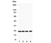 Western blot testing of DHFR antibody and Lane 1:  rat liver;  2: mouse liver;  3: human HepG2;  4: (h) Jurkat.  Expected molecular weight 21~24 kDa.