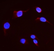 Western blot testing of DHFR antibody and Lane 1:  rat liver;  2: mouse liver;  3: human HepG2;  4: (h) Jurkat.  Expected molecular weight 21~24 kDa.