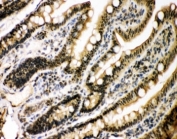 IHC-P: p300 antibody testing of rat intestine tissue