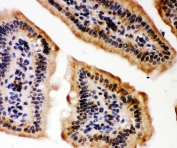 IHC-P: p300 antibody testing of mouse intestine tissue