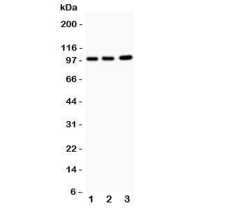 Western blot testing of EPB41L1 antibody and Lane 1: rat brain; 2: mouse brain; 3: human A549. Predicted/observed size ~99KD~