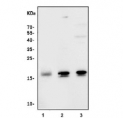 Western blot testing of 1) human Raji, 2) rat brain and 3) rat kidney tissue lysate with FHIT antibody.  Predicted molecular weight: ~17 kDa.