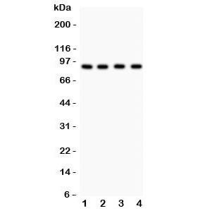 Western blot testing of Furin antibody and Lane 1: HeLa; 2: MCF-7; 3: COLO320; 4: SW620. Predicted/observed size ~88KD~