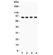 Western blot testing of Furin antibody and Lane 1:  HeLa;  2: MCF-7;  3: COLO320;  4: SW620. Observed molecular weight 90~110 kDa (precusor/mature may be glycosylated).