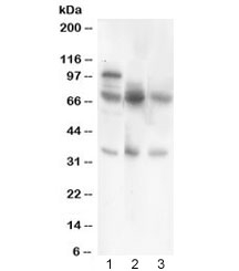 Western blot testing of GAD67 antibody and Lane 1: rat brain; 2: human HeLa; 3: (h) COLO320. Predicted/observed size ~67KD~