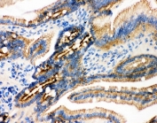 IHC(P) testing of Plakoglobin antibody and mouse intestine tissue. HIER: steam section in pH6 citrate buffer for 20 min.