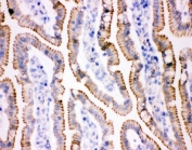 IHC staining of frozen rat intestine tissue.