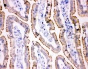 IHC staining of frozen rat intestine tissue.