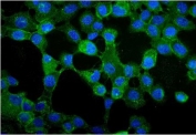 Immunofluorescent staining of FFPE human A431 cells with Plakoglobin antibody (green) and DAPI nuclear stain (blue). HIER: steam section in pH6 citrate buffer for 20 min.