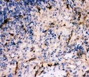 IHC-P: C5 antibody testing of FFPE rat spleen tissue. HIER: boil tissue sections in pH6, 10mM citrate buffer, for 10-20 min and allow to cool before testing.
