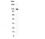 Western blot testing of C5 antibody and rat liver lysate;  Predicted molecular weight: ~115 kDa (C5 alpha chain).