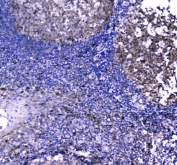 IHC-P: Caspase-3 antibody testing of mouse intestine tissue.