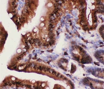 IHC-P: Caspase-3 antibody testing of mouse intestine tissue