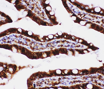 IHC-P: Caspase-3 antibody testing of rat intestine tissue