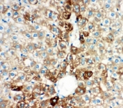 IHC testing of FFPE rat liver tissue with CYP2E1 antibody at 1ug/ml. Required HIER: steam section in pH6 citrate buffer for 20 min and allow to cool prior to staining.