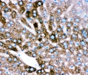 IHC testing of FFPE mouse liver tissue with CYP2E1 antibody at 1ug/ml. Required HIER: steam section in pH6 citrate buffer for 20 min and allow to cool prior to staining.