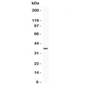 Western blot testing of Estrogen Receptor antibody and recombinant human protein (0.5ng)