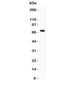 Western blot testing of Estrogen Receptor antibody and MCF-7 lysate (human breast tumor cell line). Predicted/observed size ~67KD