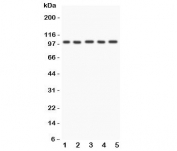 Western blot testing of FGFR4 antibody and Lane 1:  HeLa;  2: PANC;  3: SGC;  4: COLO320;  5: SW620;  Observed molecular weight: 88~125 kDa depending on phosphorylation and glycosylation level.