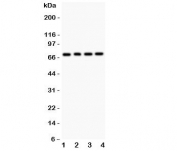 Western blot testing of FOXO1 antibody and Lane 1:  rat lung;  2: (r) brain;  3: human COLO320;  4: (h) HEPG2.  Predicted molecular weight: ~70kDa