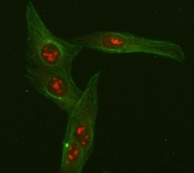 Immunofluorescent staining of FFPE human U-2 OS cells with FOXO3A antibody (red) and Beta Tubulin mAb (green). HIER: steam section in pH6 citrate buffer for 20 min.