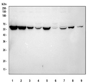 Western blot testing of G6PD antibody and Lane 1: HeLa; 2: MCF-7; 3: SKOV; 4: HEPG2. Predicted/observed size ~59KD~