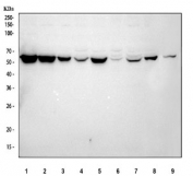 Western blot testing of 1) human A549, 2) human MCF7, 3) human HeLa, 4) human U-2 OS, 5) human U-251, 6) human A431, 7) human HepG2, 8) human RT4 and 9) mouse RAW264.7 cell lysate with G6PD antibody. Predicted molecular weight ~59 kDa.