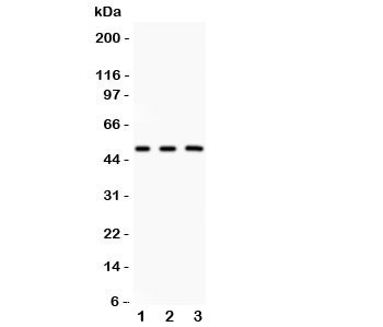 Western blot testing of GATA3 antibody and Lane 1: rat brain; 2: human MCF-7; 3: (h) HEPG2. Predicted molecular weight: 50 kDa~